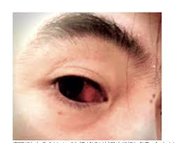 本站内容可能令人反感；不将本站内容派发，出售。 出租，交给或出借予年龄未满18岁人士出示，播放或播映。 this article contains material which may offernd and may not be distributed,circulated,sold,hired,given,lent,shown, played or projected to a. Jwmc9uot8vm39m