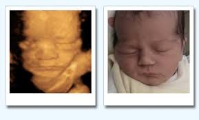 Ssw ist die lunge endlich soweit, selbstständig zu atmen. Baby 3d Ultraschall Studio Babyfacing De Beitrage Facebook