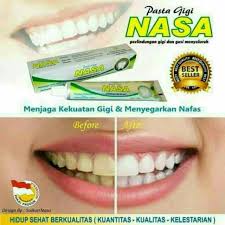 Pasta Gigi Nasa Pemutih Gigi Penghilang Karang Gigi Shopee Indonesia