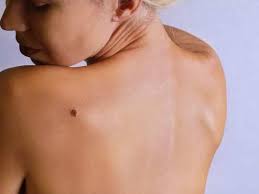 A lump in the neck. Cancer Symptoms à´‡à´¤ à´• à´• à´• àµ»à´¸à´± à´¨ à´± à´¸ à´šà´¨à´•à´³ à´£ à´…à´µà´—à´£ à´• à´•à´° à´¤ Never Ignore These Signs And Symptoms Of Cancer Samayam Malayalam