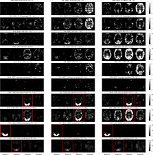 Spm 2018 sila jawab semua soalan. Accurate Autocorrelation Modeling Substantially Improves Fmri Reliability Nature Communications
