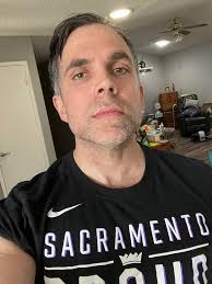 Embracing self-acceptance with facial muscle atrophy