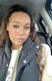 I looked like a tomato for a week and felt like my face was going to  explode