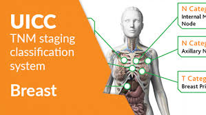 Image result for Breast Cancer Staging
