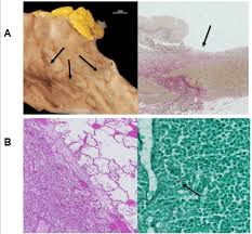 It was designed to be an extensible platform . Autopsy Results Post Mortem Analysis Revealed Bowel Wall Injuries Due Download Scientific Diagram