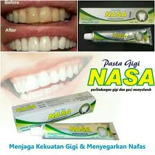 Jual Pasta Gigi Nasa Odol Nasa Pemutih Gigi Kota Medan Srb Tokopedia