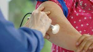 Schuppenflechte Erkennen Und Behandeln Ndr De Ratgeber Gesundheit