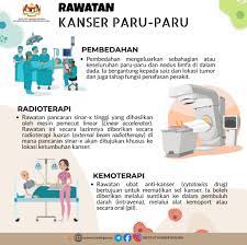 Cara merawat burung lovebird di tempat yang nyaman. Laman Rasmi Institut Kanser Negara Kanser Paru Paru Sukar Untuk Dikesan Pada Peringkat Awal Disebabkan Tanda Tanda Yang Minimum Pada Mulanya Keberkesanan Rawatan Juga Bergantung Kepada Peringkat Penyakit Ketiga Diagnosis Kanser Paru Paru Boleh