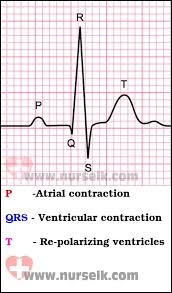 How To Read An Electrocardiogram Ecg Part 1 Pqrst Waves Nurselk Com