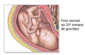 33 Semanas De Gestacao Trocandofraldas Com Br