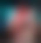 Image result for Ischiorectal Abscess