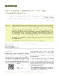 Кирк дуглас, лоуренс оливье, джин симмонс и др. Pdf Tattoo Associated Complications And Related Topics A Comprehensive Review
