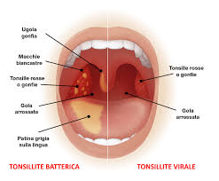 Image result for tonsilla palatina
