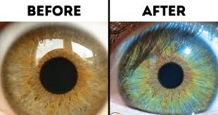 7 Things That Can Change Your Eye Color Change Your Eye Color Eye Color Change Eye Color
