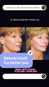 دكتور حسين هاشم: شفط الدهون والتجميل في بيروت