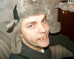 Curtis Rice, Redneck without dental insurance