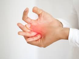 Image result for Paresthesia