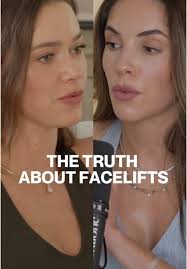 The Changing Perception of Facelifts and Aging