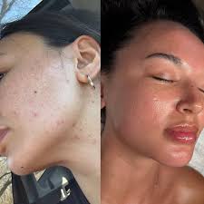 Looking to hire massage therapists!