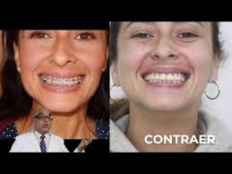 Julio Puma Ortodoncia