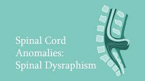 Image result for Dysraphism