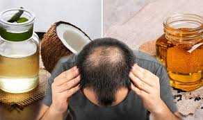 Serums may work better on coarser hair types to tame frizz and add shine. Hair Loss Treatment Stop Hair Loss Loss With Coconut Oil And Black Seeds Nigella Sativa Express Co Uk