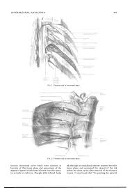 Image result for Intrapleural Anesthesia