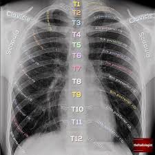Review The Bones Read On For Some Tips On Reviewing Bones On A Chest X Ray I D Radiology Student Medical Knowledge Medical School Studying
