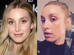 Some symptoms of snow blindness include pain, blurry vision, swelling, and watery eyes. What Celebrities Look Like When They Re Not Wearing Makeup