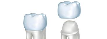 Set twitter profile banner to a random image from a specified folder or a list of paths. Keramikkrone Die Asthetische Und Allergiefreie Krone Dentolo