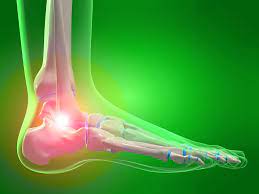 Compression Socks For Gout Immediate Relief