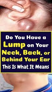 Do You Ve A Lump On Your Neck Back Or Behind Your Ear That Is What It Means Alumpundertheskin Hardlumpund Skin Bumps Health Articles Wellness Sagging Skin