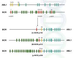 Different Fusion Form Of Bcr Abl1 Genes In Philadelphia Chromosome Leukemia Symptoms Chromosomal Abnormalities Chromosome