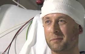 Comedian Dylan Avila attacked with metal baseball bat during performance