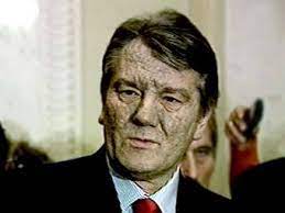 Дослідження родоводу за прізвищем ющенко. Yushenko Raskryl Tajnu Svoego Otravleniya Mir Lenta Ru