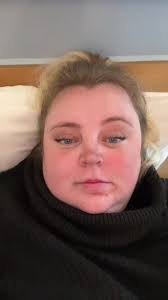 Addison Brinkley Roids