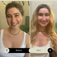 TOP 10 BEST Scalp Treatment in Thousand Oaks, CA