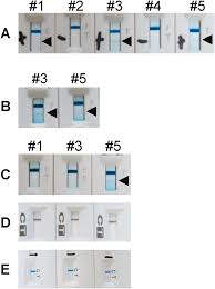 It can be done in a clinic, doctor's office, or hospital. False Positive Results In Severe Acute Respiratory Coronavirus 2 Sars Cov 2 Rapid Antigen Tests For Inpatients Journal Of Infection And Chemotherapy