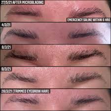 If you want to what is eyebrow tattoo process or microblading vs eyebrow tattoo | which one is better? Update Botched Microblading Emergency Saline Treatment Healing Microblading