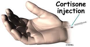Learn more about the symptoms, causes, diagnosis, treatment. Carpal Tunnel Syndrome Orthogate