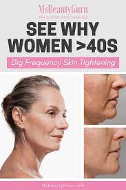 What Is Rf Skin Tightening And Why Women Above 40 Loves It Radio Frequency Skin Tightening Skin Tightening Procedures Skin Tightening
