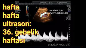 35 haftalık bebek kaç kilo olmalı? 36 Gebelik Haftasinda Anne Karnindaki Bebek Az Kilo Alimi Solunum Hareketleri Ve Renkli Doppler Youtube