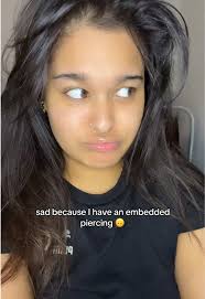 I’m scared to go hospital 😟 #embeddedpiercing #embedded #piercing #helix  #helixpiercing