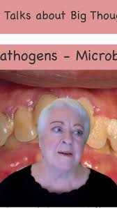 Learn about keystone pathogens and why they are the microbial bullies of  the mouth. , ., ., ., ., #anneguignon #alwayslearning #rdhforlife  #dentalhygiene #dentalhygiene #biology #dentalnerd