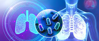 TB (Tuberculosis) - Wirral Community Health and Care NHS Foundation Trust