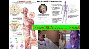 1ere Enquete Maladie De Charcot Sla Sclerose Laterale Amyotrophyque Veritable Cause Traitement Youtube
