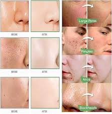 Image result for Grevea