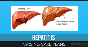 Pin On Nursing Care Plans