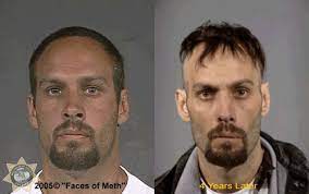 In recent years, the recreational use of methamphetamine has skyrocketed in the united states. Photos How Methamphetamine Destroys Your Face And Physical Appearance Abc13 Houston