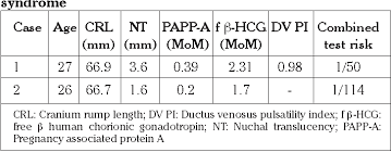Table 2 From The Assessment Of Nuchal Translucency And Serum Markers For Down Syndrome Screening With Ductus Venosus Doppler Measurements In The First Trimester Semantic Scholar